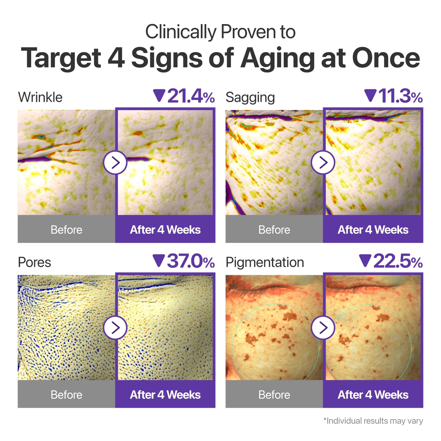 کرم دور چشم جوانساز رتینال نامبوزین Numbuzin No.9 NAD+ Retinal Volumetox Eye Cream – حجم ۲۰ میل