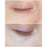 سرم دور چشم رولینگ کلاژن فارم استی (Farm Stay Collagen Water Full Moist Rolling Eye Serum) حجم 25 میلیلیتر