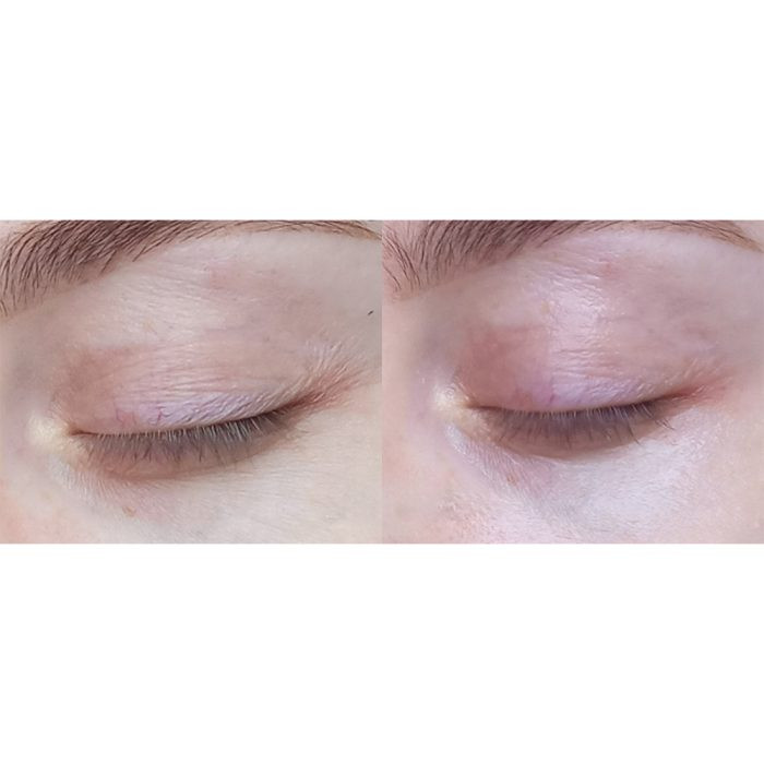 سرم دور چشم رولینگ کلاژن فارم استی (Farm Stay Collagen Water Full Moist Rolling Eye Serum) حجم 25 میلیلیتر