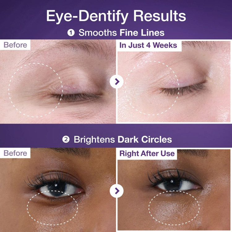 کرم دور چشم رتینول و +NAD نامبوزین مدل No.9 NAD+ Retinol Volumetox Eye Cream حجم 10 میلیلیتر