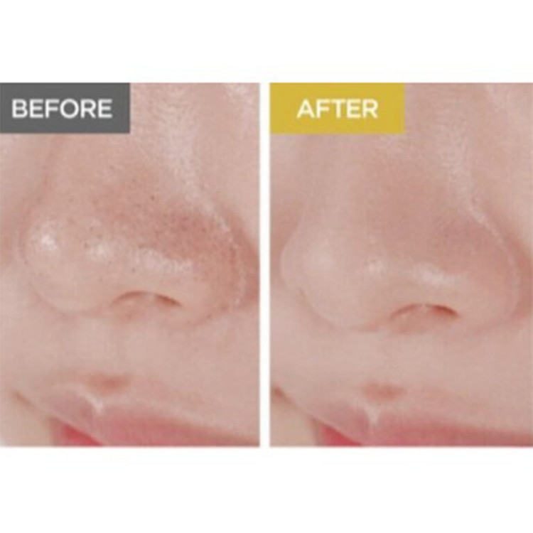 شوینده روغنی ملایم سنتلا ماداگاسکار اسکین 1004 SKIN 1004 Madagascar Centella Light Cleansing Oil