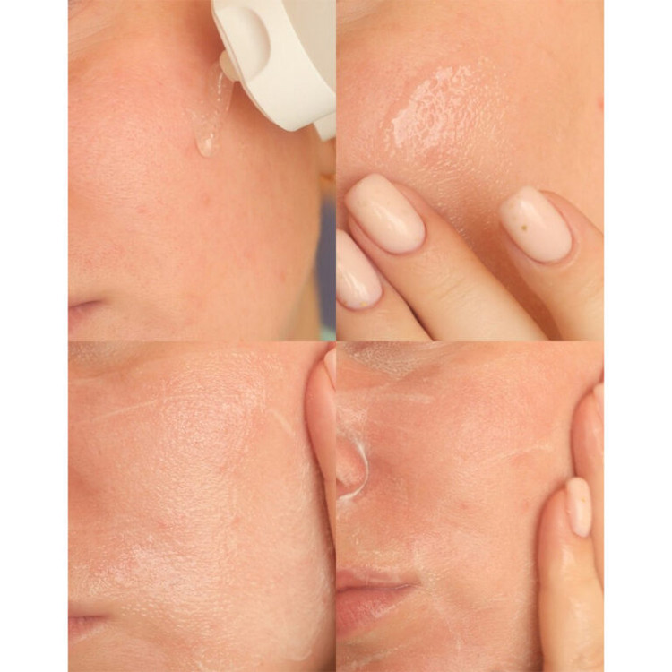 ژل شستشوی روشن کننده و تسکین دهنده سنتلا اسکین 1004 Skin1004 Madagascar Centella Tone Brightening Cleansing Gel Foam