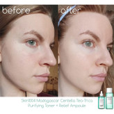 سرم سنتلا ماداگاسکار تسکین دهنده چای تریکا اسکین 1004 Skin1004 Madagascar Centella Tea-Trica Relief Ampoule