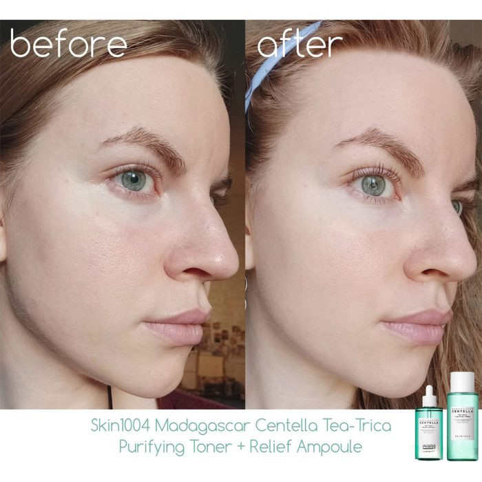 سرم سنتلا ماداگاسکار تسکین دهنده چای تریکا اسکین 1004 Skin1004 Madagascar Centella Tea-Trica Relief Ampoule