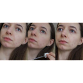سرم التیام بخش سنتلا ماداگاسکار اسکین 1004 SKIN1004 Madagascar Centella Ampoule