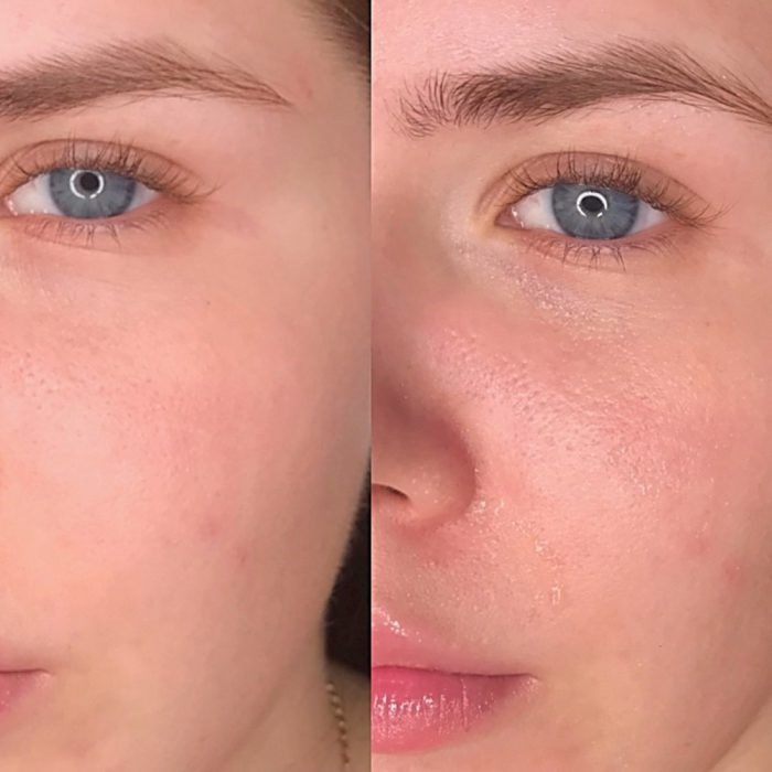 سرم التیام بخش سنتلا ماداگاسکار اسکین 1004 SKIN1004 Madagascar Centella Ampoule