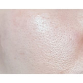 سرم کنترل و کوچک کننده منافذ سنتلا ماداگاسکار SKIN 1004 Poremizing Fresh Ampoule