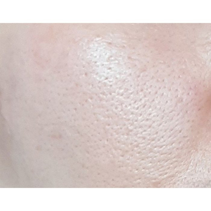 سرم کنترل و کوچک کننده منافذ سنتلا ماداگاسکار SKIN 1004 Poremizing Fresh Ampoule