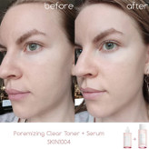 سرم کنترل و کوچک کننده منافذ سنتلا ماداگاسکار SKIN 1004 Poremizing Fresh Ampoule