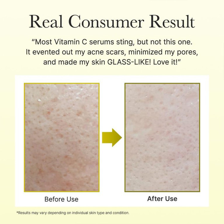 بوستر شات ویتامین سی و گلوتاتیون روشن کننده و ضدلک آرنسیا Arencia vitamin c booster shot