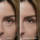 کرم دور چشم ضد پف رتینول دکتر ملاکسینDr. Melaxin Retinol Eyephalt Eyebag Cream