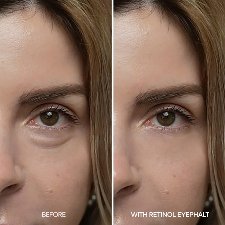 کرم دور چشم ضد پف رتینول دکتر ملاکسینDr. Melaxin Retinol Eyephalt Eyebag Cream