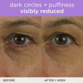 کرم دور چشم روشن کننده Brightening تاچا 15 میل